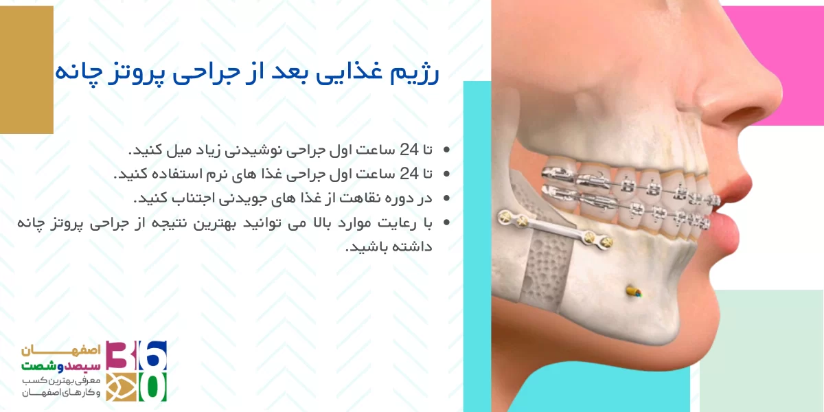 جراحی چانه در اصفهان 