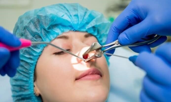 جراح بینی استخوانی در اصفهان
