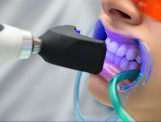 بهترین دکتر بلیچینگ دندان در اصفهان