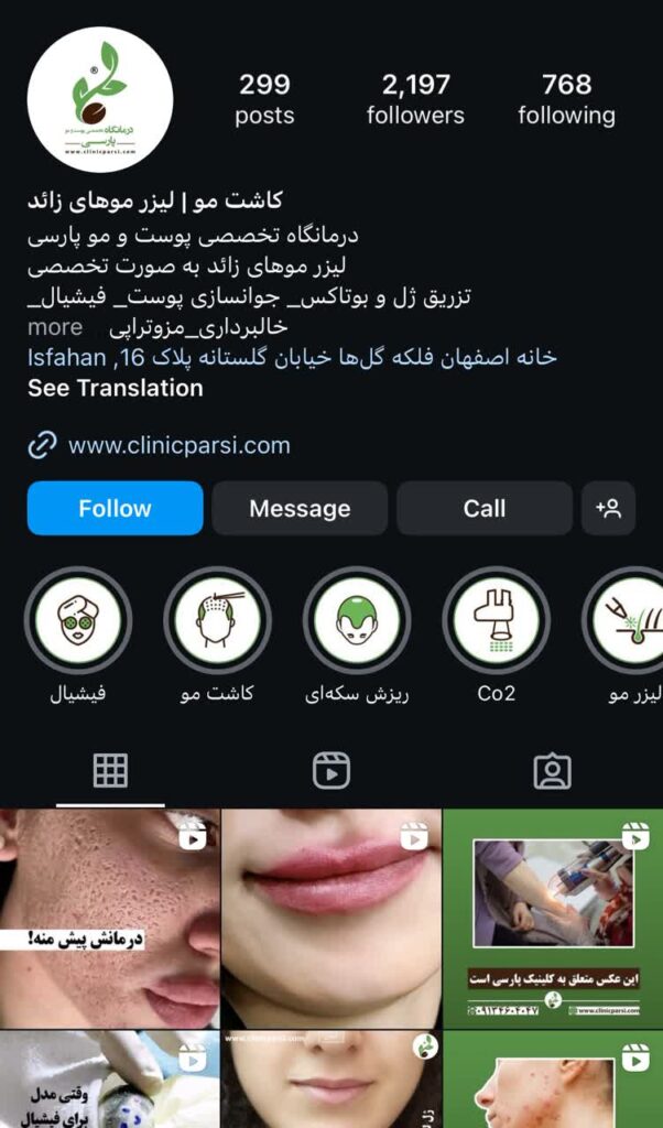 لیفت صورت با نخ در اصفهان