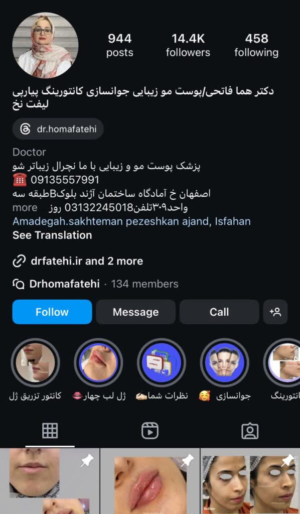 لیفت صورت با نخ در اصفهان