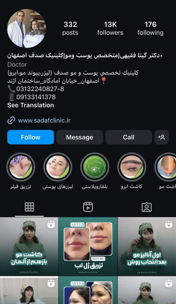 لیفت صورت با نخ در اصفهان